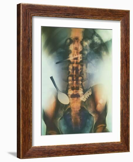 Coloured X-ray of Spoon And Blade In Intestine-Science Photo Library-Framed Photographic Print