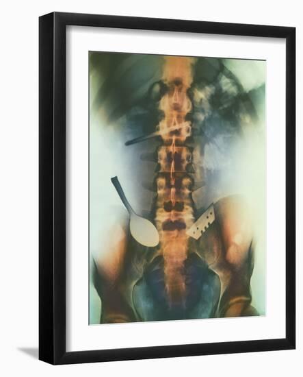 Coloured X-ray of Spoon And Blade In Intestine-Science Photo Library-Framed Photographic Print