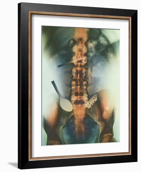 Coloured X-ray of Spoon And Blade In Intestine-Science Photo Library-Framed Photographic Print