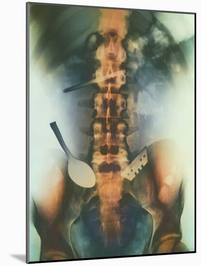 Coloured X-ray of Spoon And Blade In Intestine-Science Photo Library-Mounted Photographic Print