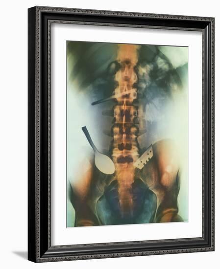 Coloured X-ray of Spoon And Blade In Intestine-Science Photo Library-Framed Photographic Print