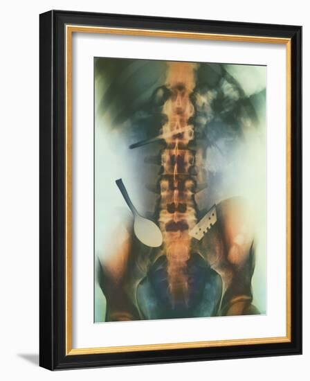 Coloured X-ray of Spoon And Blade In Intestine-Science Photo Library-Framed Photographic Print