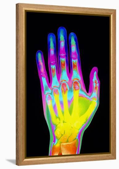 Coloured X-ray of the Healthy Hand of a Man-Mehau Kulyk-Framed Premier Image Canvas