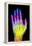 Coloured X-ray of the Healthy Hand of a Man-Mehau Kulyk-Framed Premier Image Canvas