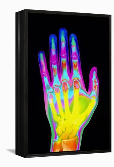 Coloured X-ray of the Healthy Hand of a Man-Mehau Kulyk-Framed Premier Image Canvas