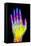 Coloured X-ray of the Healthy Hand of a Man-Mehau Kulyk-Framed Premier Image Canvas