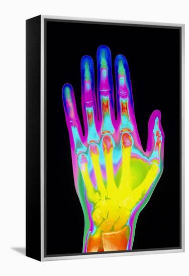 Coloured X-ray of the Healthy Hand of a Man-Mehau Kulyk-Framed Premier Image Canvas