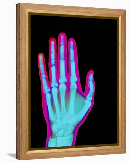 Coloured X-ray of the Healthy Hand of a Man-Mehau Kulyk-Framed Premier Image Canvas