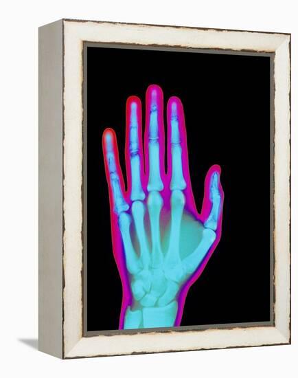 Coloured X-ray of the Healthy Hand of a Man-Mehau Kulyk-Framed Premier Image Canvas