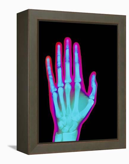 Coloured X-ray of the Healthy Hand of a Man-Mehau Kulyk-Framed Premier Image Canvas