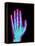 Coloured X-ray of the Healthy Hand of a Man-Mehau Kulyk-Framed Premier Image Canvas