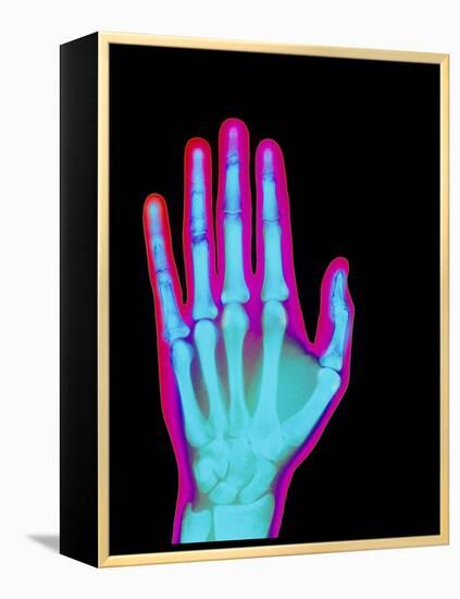 Coloured X-ray of the Healthy Hand of a Man-Mehau Kulyk-Framed Premier Image Canvas