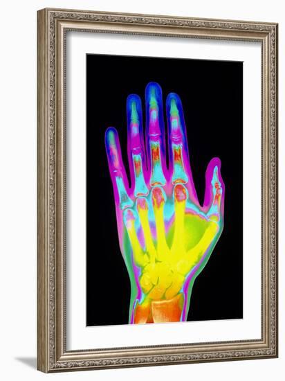 Coloured X-ray of the Healthy Hand of a Man-Mehau Kulyk-Framed Photographic Print