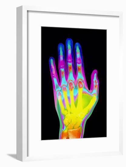 Coloured X-ray of the Healthy Hand of a Man-Mehau Kulyk-Framed Photographic Print