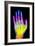 Coloured X-ray of the Healthy Hand of a Man-Mehau Kulyk-Framed Photographic Print