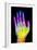 Coloured X-ray of the Healthy Hand of a Man-Mehau Kulyk-Framed Photographic Print