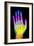 Coloured X-ray of the Healthy Hand of a Man-Mehau Kulyk-Framed Photographic Print