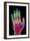 Coloured X-ray of the Healthy Hand of a Man-Mehau Kulyk-Framed Photographic Print