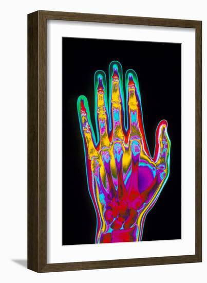 Coloured X-ray of the Healthy Hand of a Man-Mehau Kulyk-Framed Photographic Print