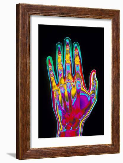 Coloured X-ray of the Healthy Hand of a Man-Mehau Kulyk-Framed Photographic Print