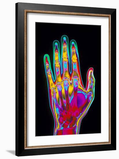 Coloured X-ray of the Healthy Hand of a Man-Mehau Kulyk-Framed Photographic Print