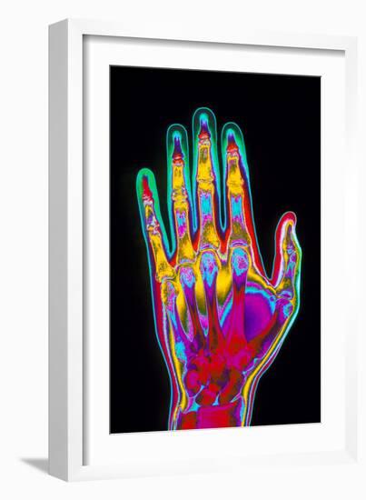 Coloured X-ray of the Healthy Hand of a Man-Mehau Kulyk-Framed Photographic Print