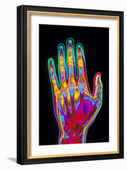 Coloured X-ray of the Healthy Hand of a Man-Mehau Kulyk-Framed Photographic Print