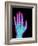 Coloured X-ray of the Healthy Hand of a Man-Mehau Kulyk-Framed Photographic Print