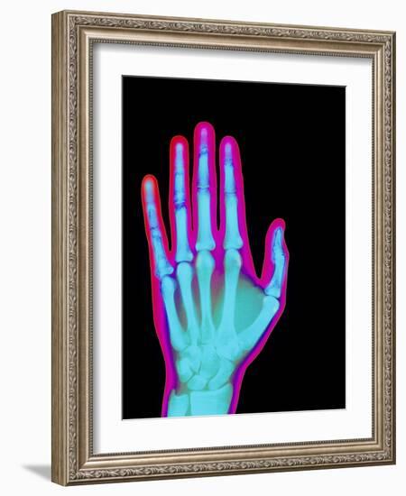 Coloured X-ray of the Healthy Hand of a Man-Mehau Kulyk-Framed Photographic Print