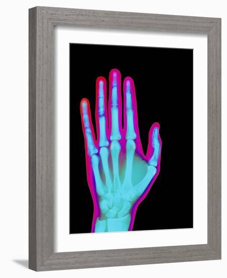 Coloured X-ray of the Healthy Hand of a Man-Mehau Kulyk-Framed Photographic Print