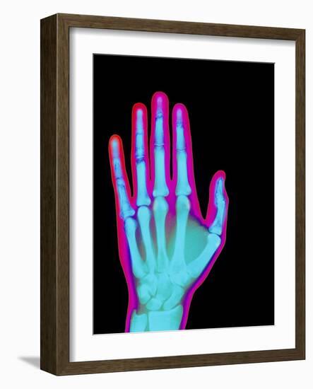 Coloured X-ray of the Healthy Hand of a Man-Mehau Kulyk-Framed Photographic Print