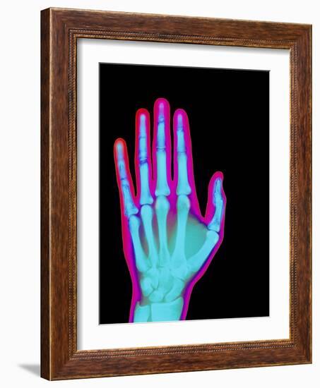 Coloured X-ray of the Healthy Hand of a Man-Mehau Kulyk-Framed Photographic Print