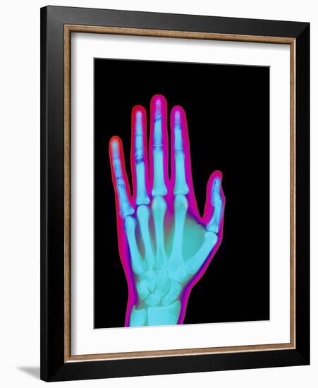 Coloured X-ray of the Healthy Hand of a Man-Mehau Kulyk-Framed Photographic Print