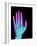 Coloured X-ray of the Healthy Hand of a Man-Mehau Kulyk-Framed Photographic Print