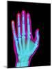 Coloured X-ray of the Healthy Hand of a Man-Mehau Kulyk-Mounted Photographic Print