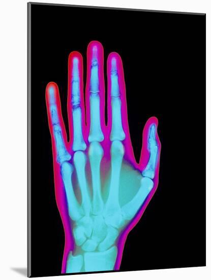 Coloured X-ray of the Healthy Hand of a Man-Mehau Kulyk-Mounted Photographic Print