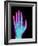 Coloured X-ray of the Healthy Hand of a Man-Mehau Kulyk-Framed Photographic Print