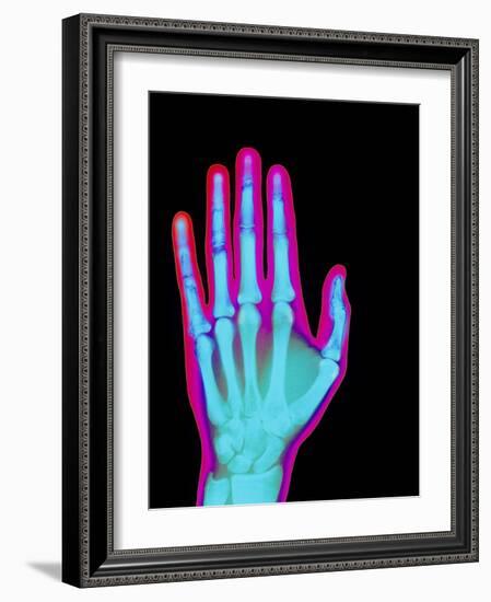 Coloured X-ray of the Healthy Hand of a Man-Mehau Kulyk-Framed Photographic Print