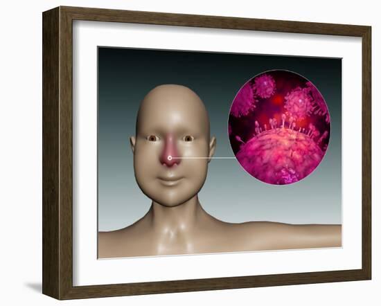 Common Cold Influenza Virus with Microscopic Close-Up-null-Framed Art Print