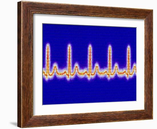 Computer Artwork of Healthy ECG Trace of the Heart-Mehau Kulyk-Framed Photographic Print