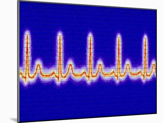 Computer Artwork of Healthy ECG Trace of the Heart-Mehau Kulyk-Mounted Photographic Print
