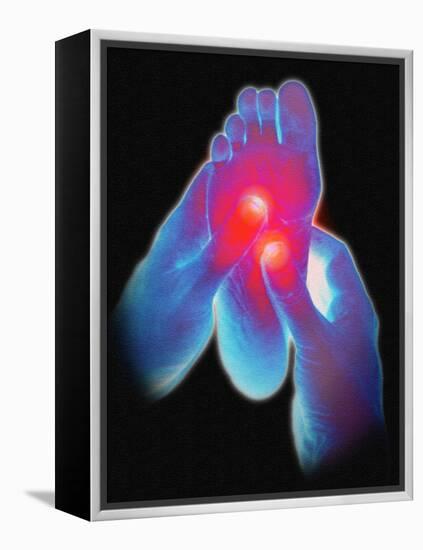 Computer Artwork of Reflexologist Massaging a Foot-David Gifford-Framed Premier Image Canvas