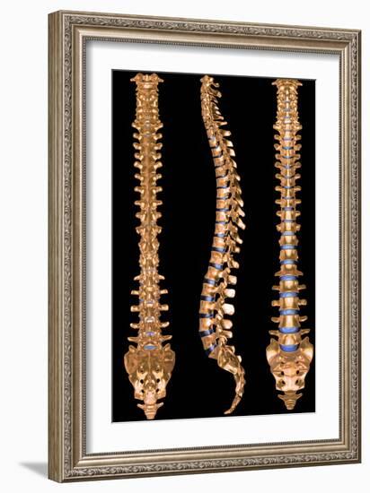 Computer Artwork of Three Views of a Human Spine-PASIEKA-Framed Photographic Print