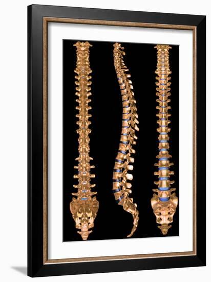 Computer Artwork of Three Views of a Human Spine-PASIEKA-Framed Photographic Print