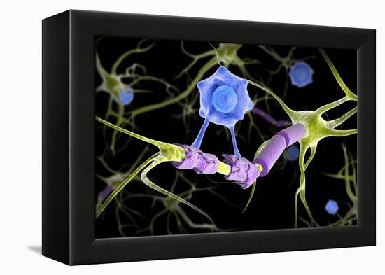 Conceptual image of a multiple sclerosis neuron healed by a T-cell.-Stocktrek Images-Framed Stretched Canvas