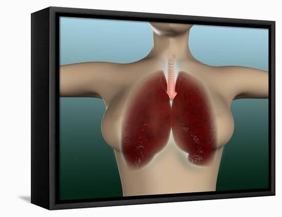 Conceptual Image of Female Body with Lungs-null-Framed Stretched Canvas