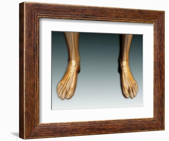 Conceptual Image of Human Legs and Feet with Nervous System-null-Framed Premium Giclee Print