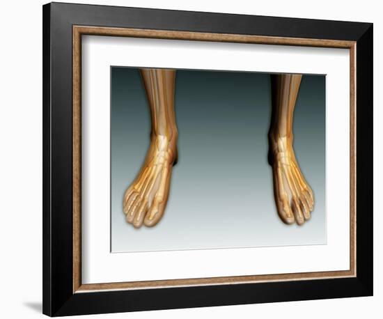 Conceptual Image of Human Legs and Feet with Nervous System-null-Framed Premium Giclee Print