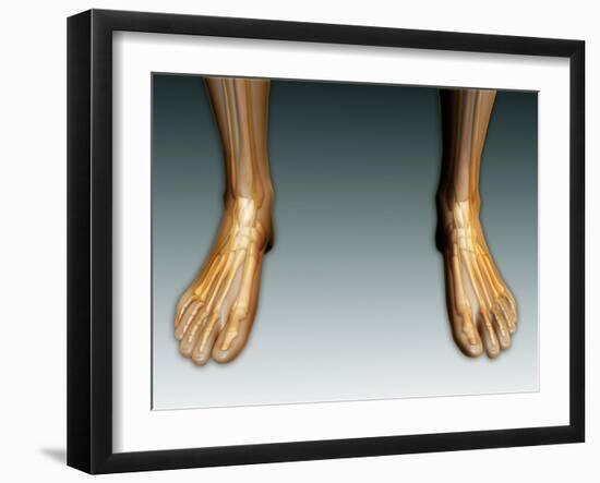 Conceptual Image of Human Legs and Feet with Nervous System-null-Framed Art Print