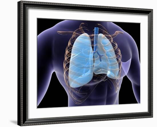 Conceptual Image of Human Lungs and Rib Cage-null-Framed Art Print